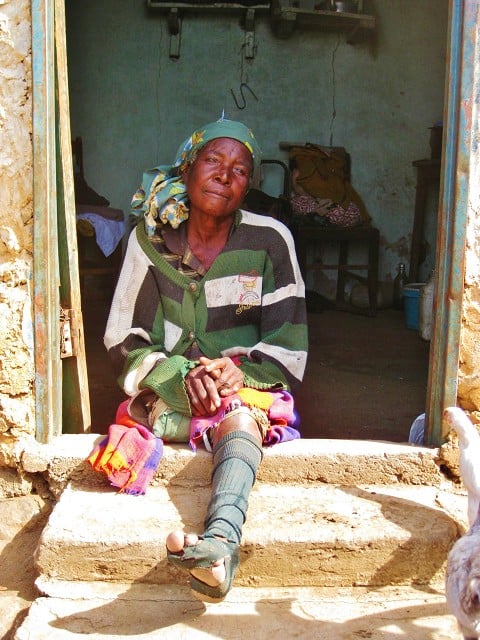 Thanks to you, Maria gets a wheelchair!